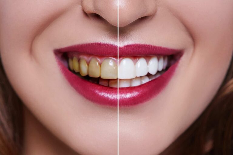Happy Smiles Dental Care